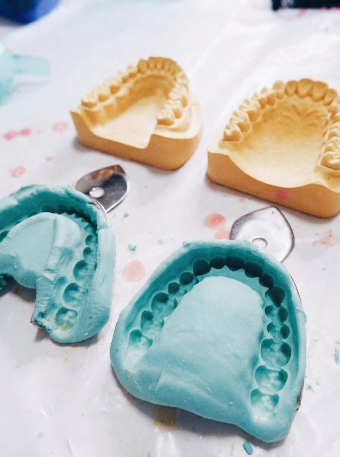 Intraoral Scanning (Digital Impression)